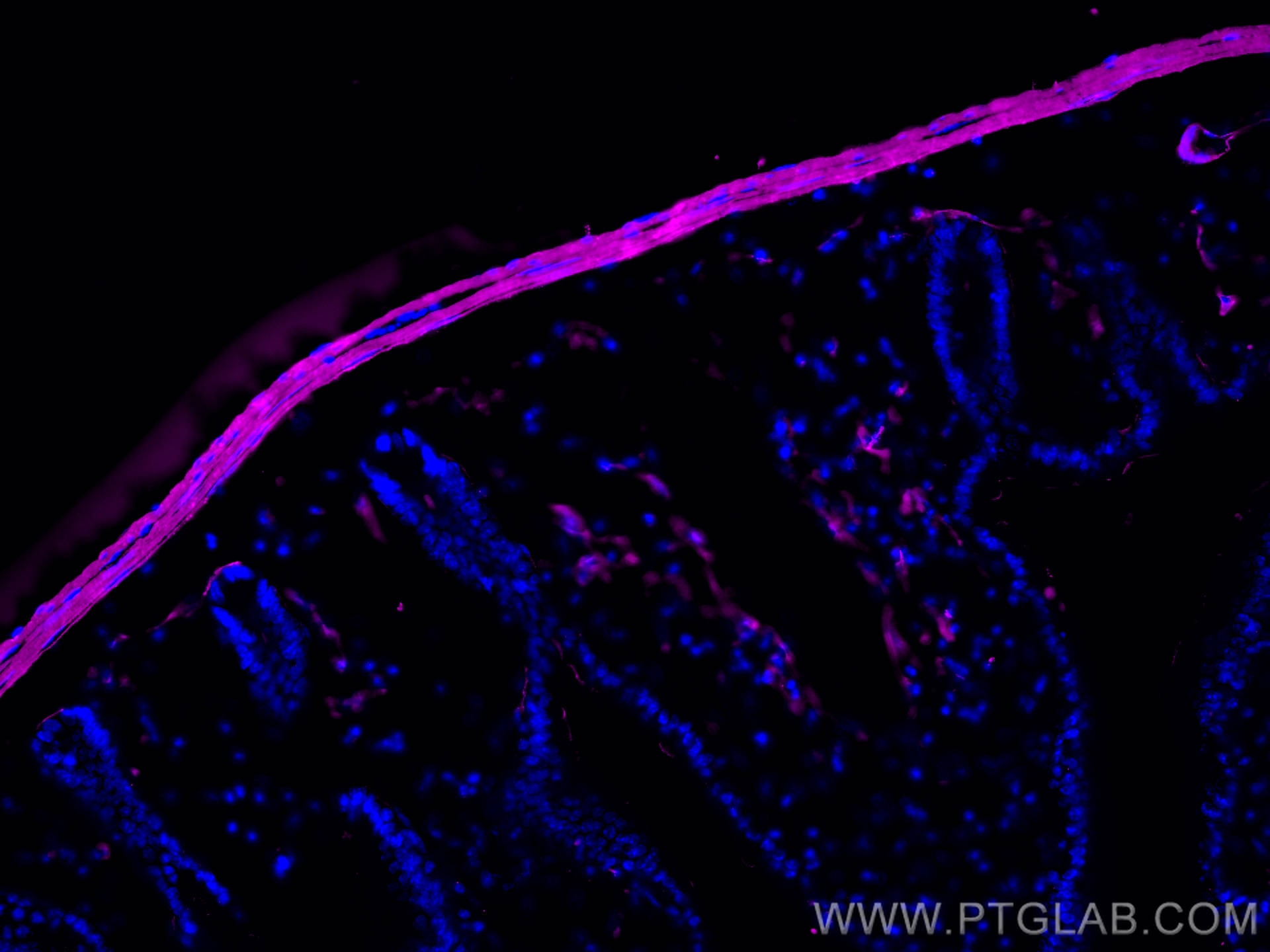 Immunofluorescent analysis of (4% PFA) fixed OCT-embedded frozen mouse small intestine tissue using smooth muscle actin antibody (14395-1-AP) at dilution of 1:400 and Multi-rAb CoraLite ® Plus 647-Goat Anti-Rabbit Recombinant Secondary Antibody (H+L) (RGAR005).