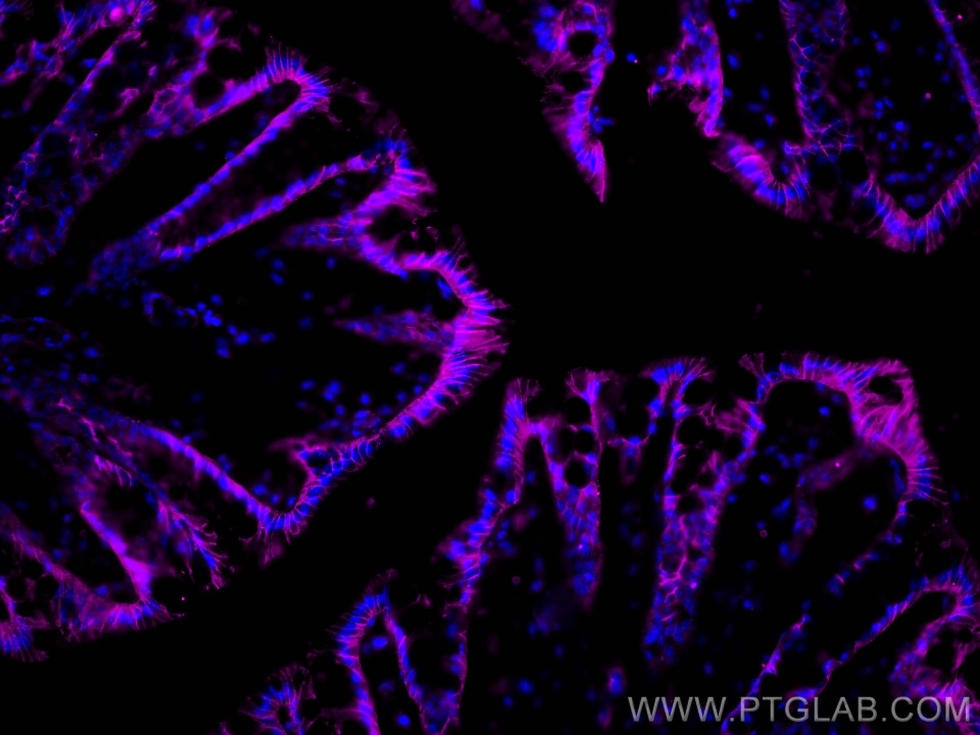 Immunofluorescent analysis of (4% PFA) fixed OCT-embedded frozen mouse colon tissue using E-cadherin antibody (20874-1-AP) at dilution of 1:400 and Multi-rAb CoraLite ® Plus 647-Goat Anti-Rabbit Recombinant Secondary Antibody (H+L) (RGAR005).