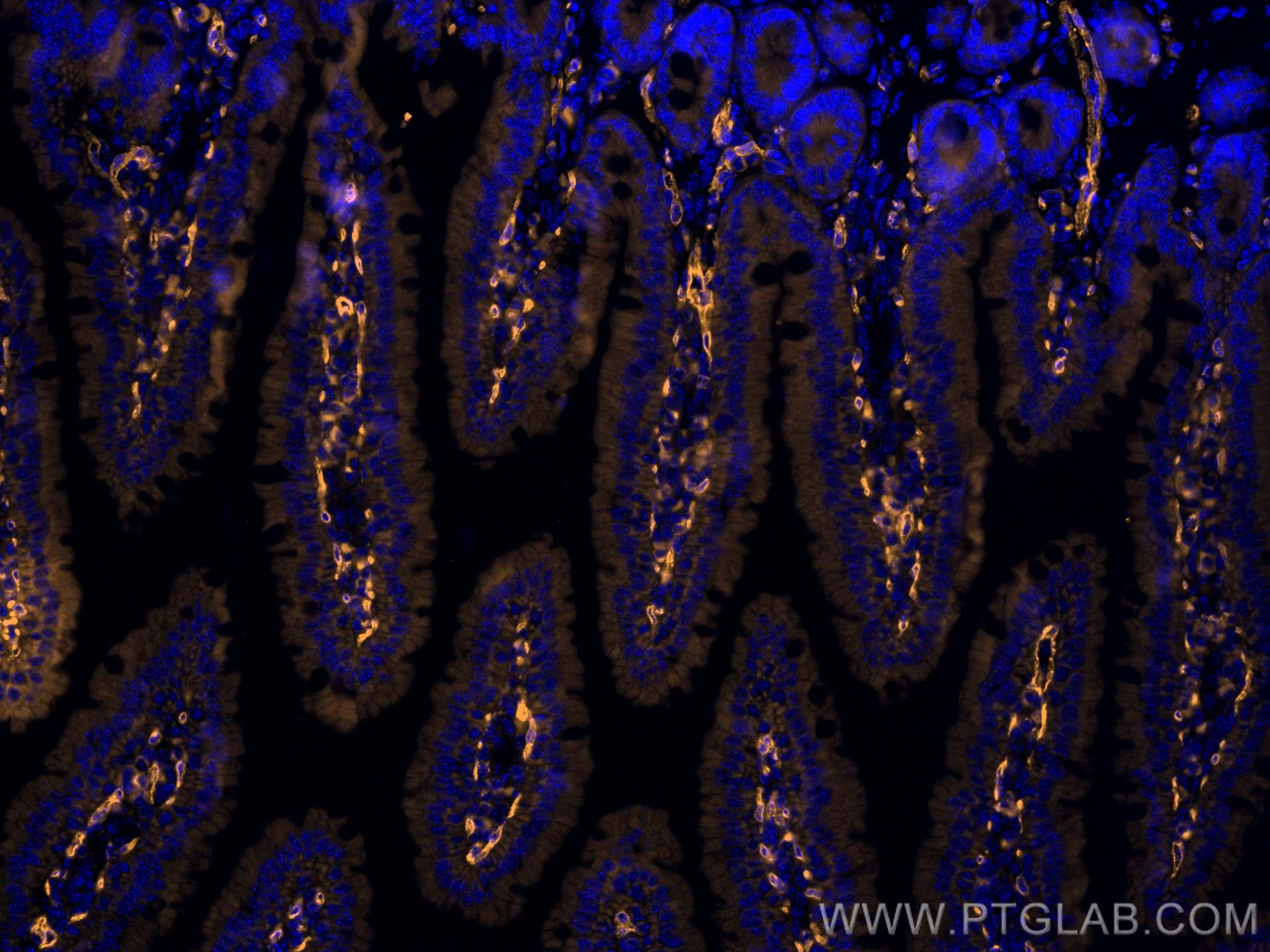 Immunofluorescent analysis of (4% PFA) fixed paraffin-embedded mouse small intestine tissue using PLVAP antibody (65214-1-Ig, Clone: MECA-32 ) at dilution of 1:250 and SA00007-7 (Rhodamine (TRITC)-conjugated Goat Anti-Rat IgG(H+L)). Heat-mediated antigen retrieval with Tris-EDTA buffer (pH 9.0).