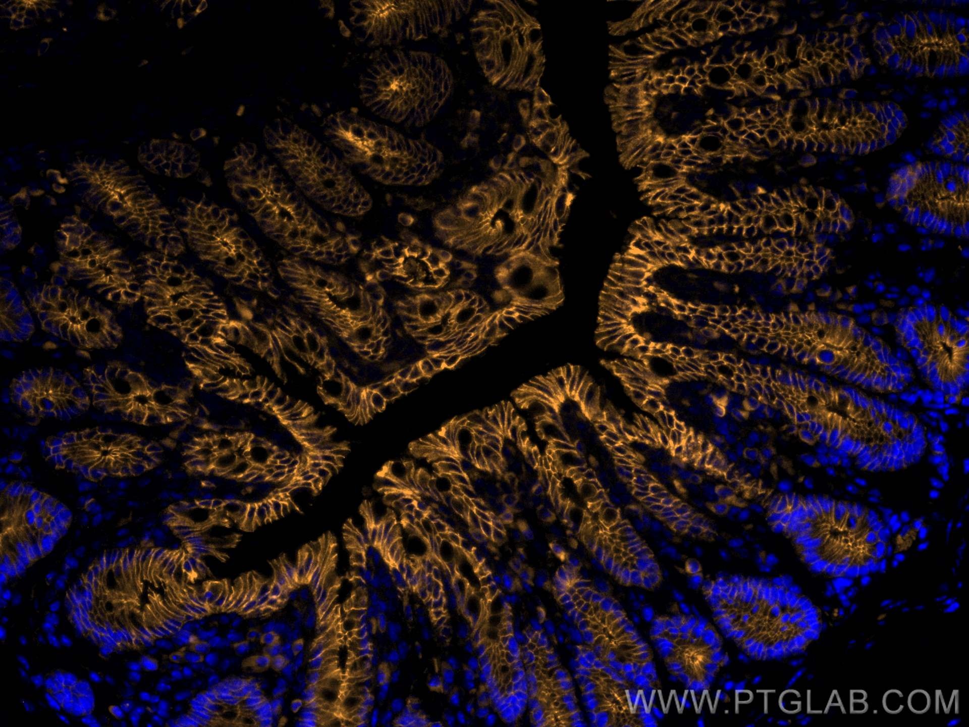 Immunofluorescent analysis of (4% PFA) fixed mouse colon tissue using CD324 (E-cadherin) antibody (65241-1-Ig, Clone: DECMA-1 ) at dilution of 1:1250 and SA00007-7 (Rhodamine (TRITC)-conjugated Goat Anti-Rat IgG(H+L)).
