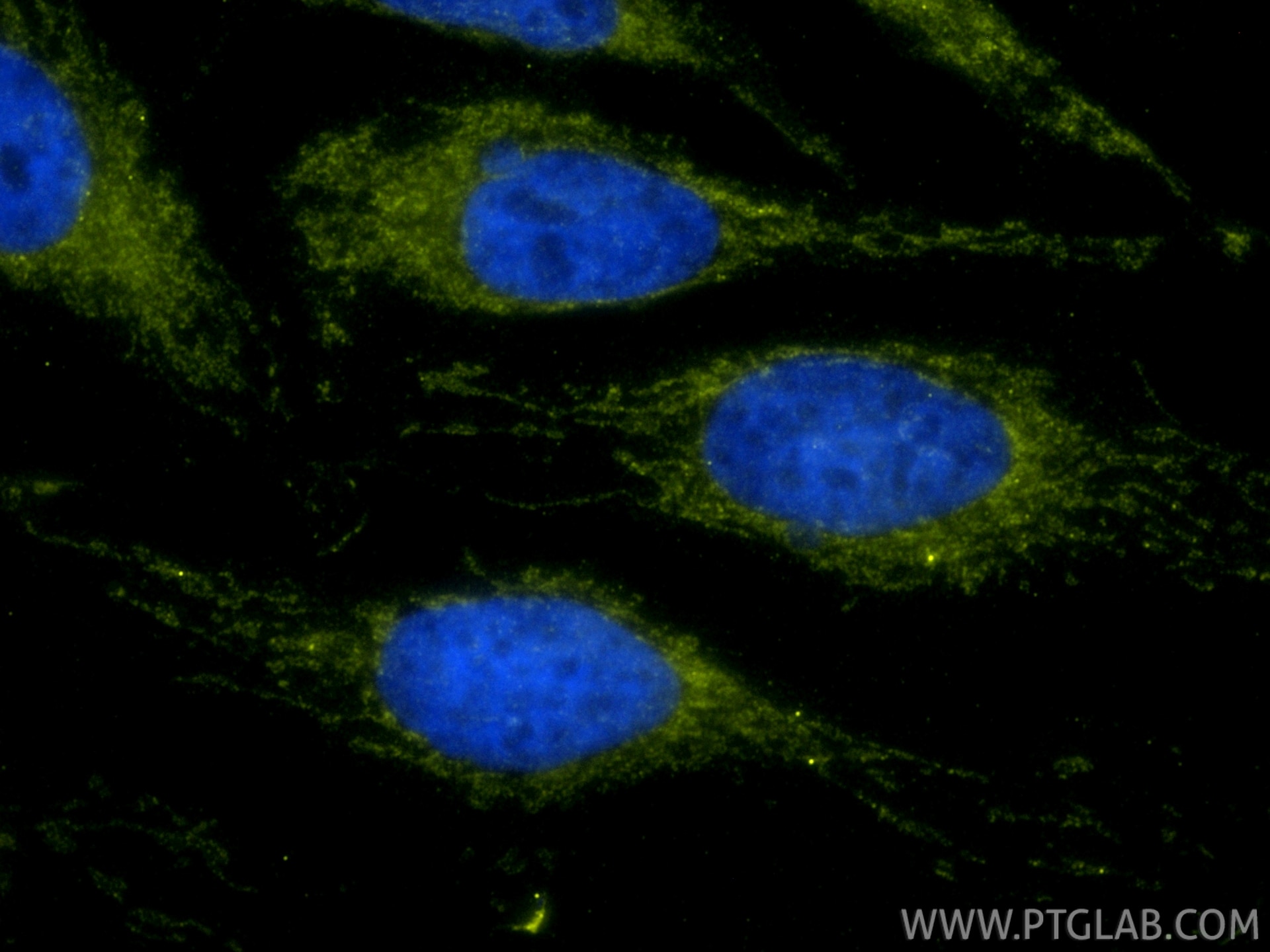 Immunofluorescent analysis of (4% PFA) fixed HeLa cells using TOM20 antibody (11802-1-AP) at dilution of 1:1000 and Goat anti Rabbit IgG,and Cy3-conjugated Donkey Anti-Goat IgG(H+L)(SA00009-3), DAPI(blue). Immunofluorescent analysis of (4% PFA) fixed HeLa cells using TOM20 antibody (11802-1-AP) at dilution of 1:1000 and Goat anti Rabbit IgG,and Cy3-conjugated Donkey Anti-Goat IgG(H+L)(SA00009-3), DAPI(blue).