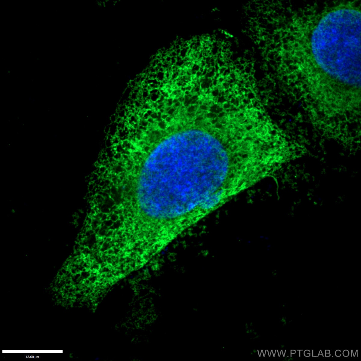 Immunofluorescent analysis of (10% Formaldehyde) fixed HepG2 cells using 10427-2-AP (Calnexin antibody) at dilution of 1:50 and CoraLite®488-Conjugated AffiniPure Goat Anti-Rabbit IgG(H+L) (SA00013-2).