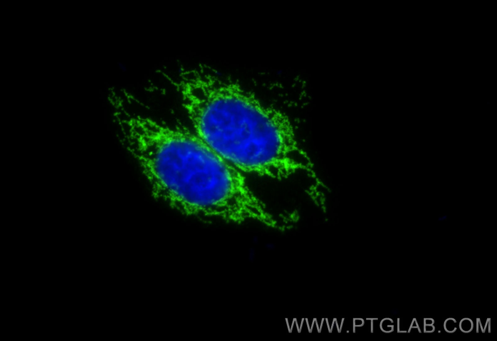 Immunofluorescent analysis of (4% PFA) fixed HepG2 cells using TOM20 antibody (11802-1-AP) at dilution of 1:200 and CoraLite488-conjugated Donkey Anti-Rabbit IgG(H+L).