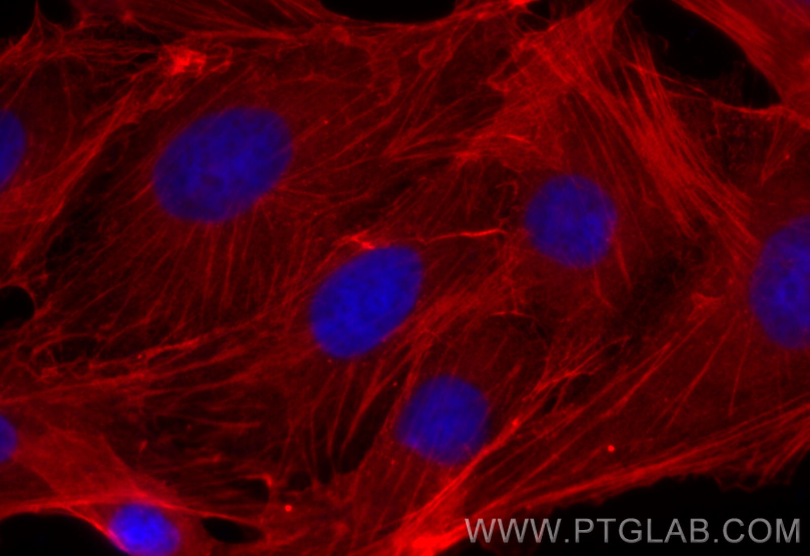 Immunofluorescent analysis of (-20°C Methanol) fixed MDCK cells using Beta Actin antibody (66009-1-Ig, Clone: 2D4H5 ) at dilution of 1:400 and CoraLite594 - conjugated Donkey Anti-Mouse IgG(H+L)(SA00013-7).