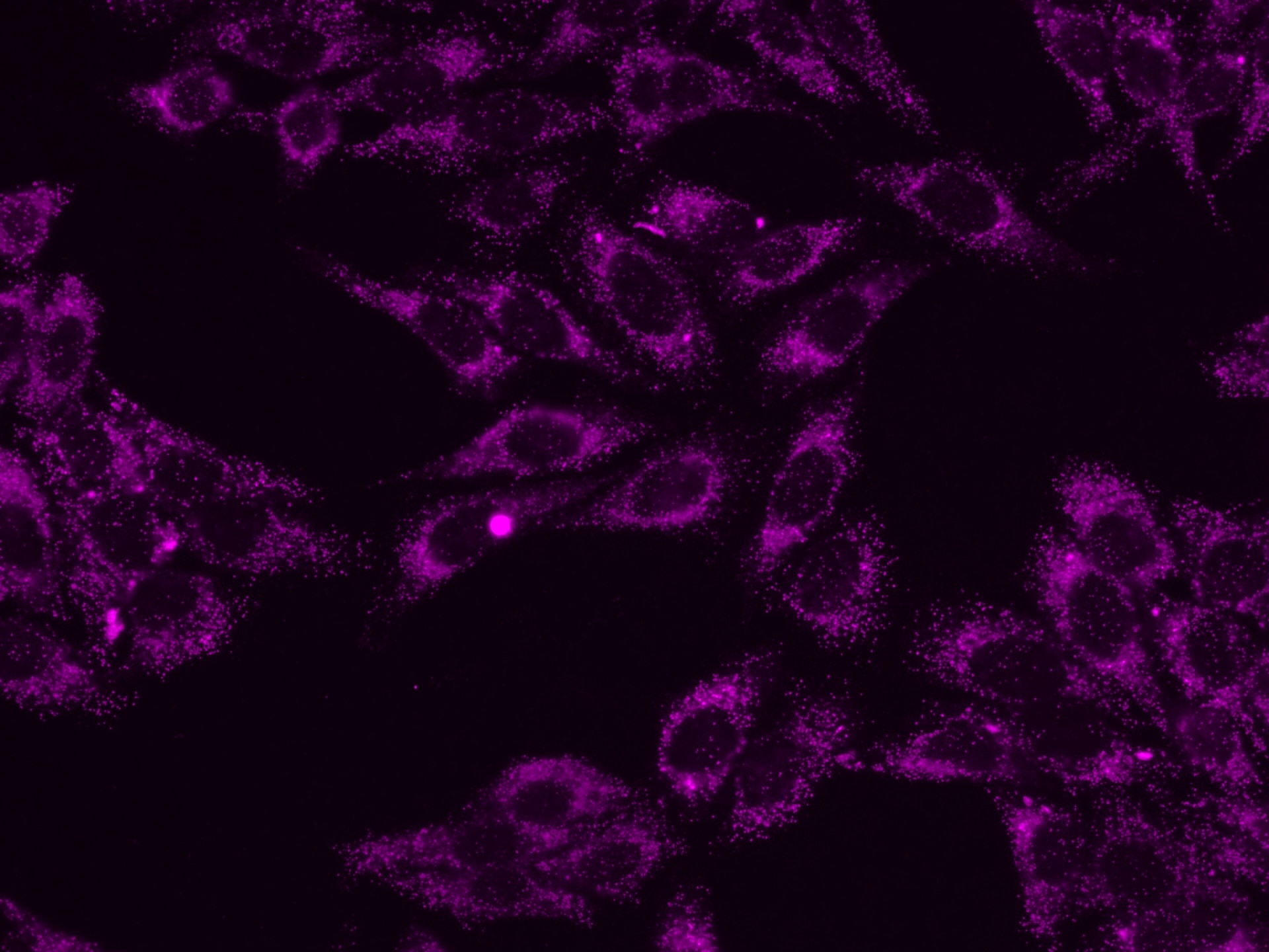 Immunofluorescent analysis of (4% PFA) fixed HeLa cells using 10594-1-AP (PEX14 antiboody) and CoraLite®647 conjugated F(ab')2 Fragment Donkey Anti-Rabbit IgG (H+L) antibody (SA00014-7) at dilution of 1:150.