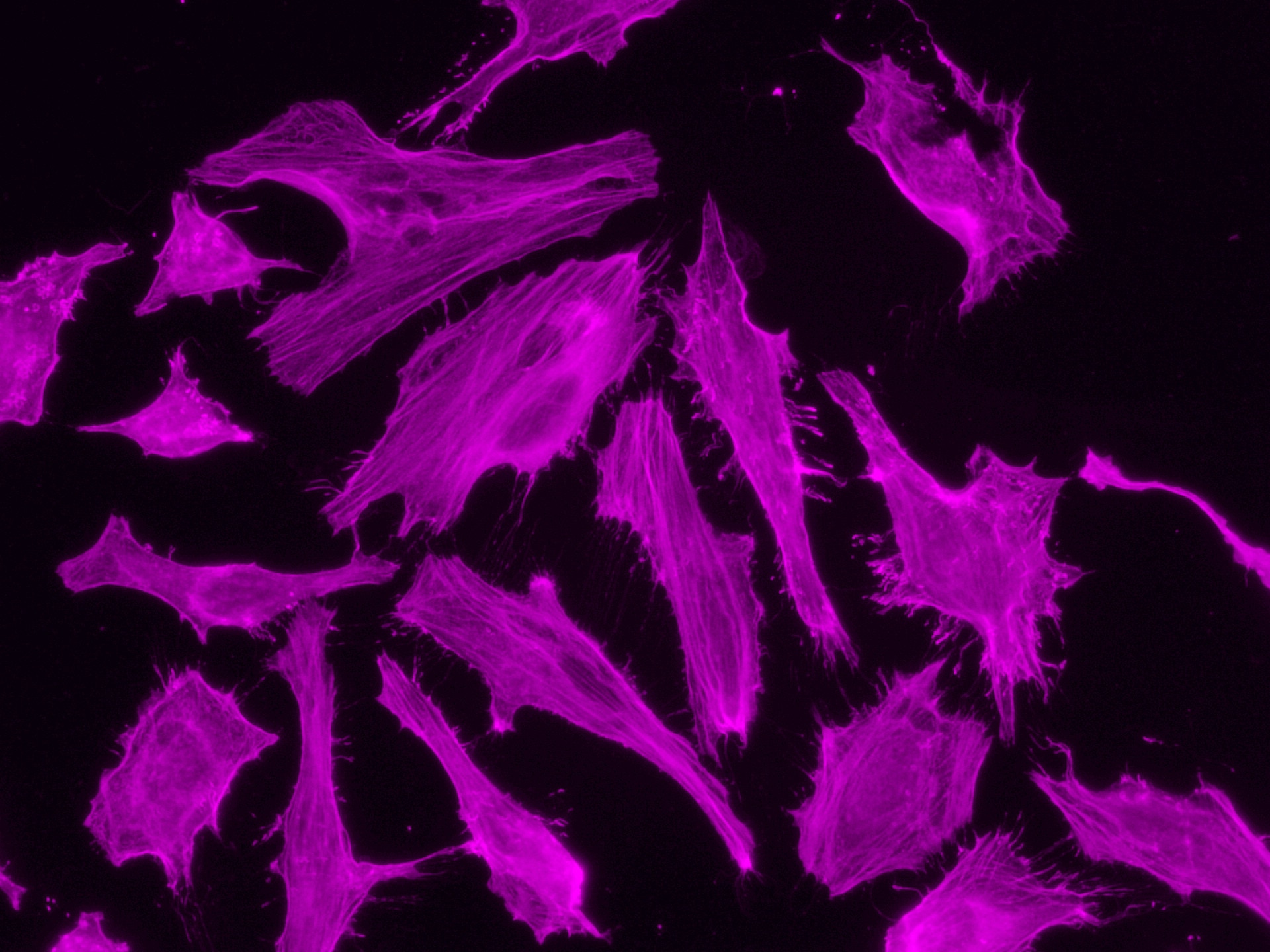 Immunofluorescent analysis of (4% PFA) fixed HeLa cells using 66009-1-Ig (Beta Actin antiboody) and CoraLite®647 conjugated AffiniPure F(ab')2 Fragment Donkey Anti-Mouse IgG (H+L) antibody (SA00014-8) at dilution of 1:150.