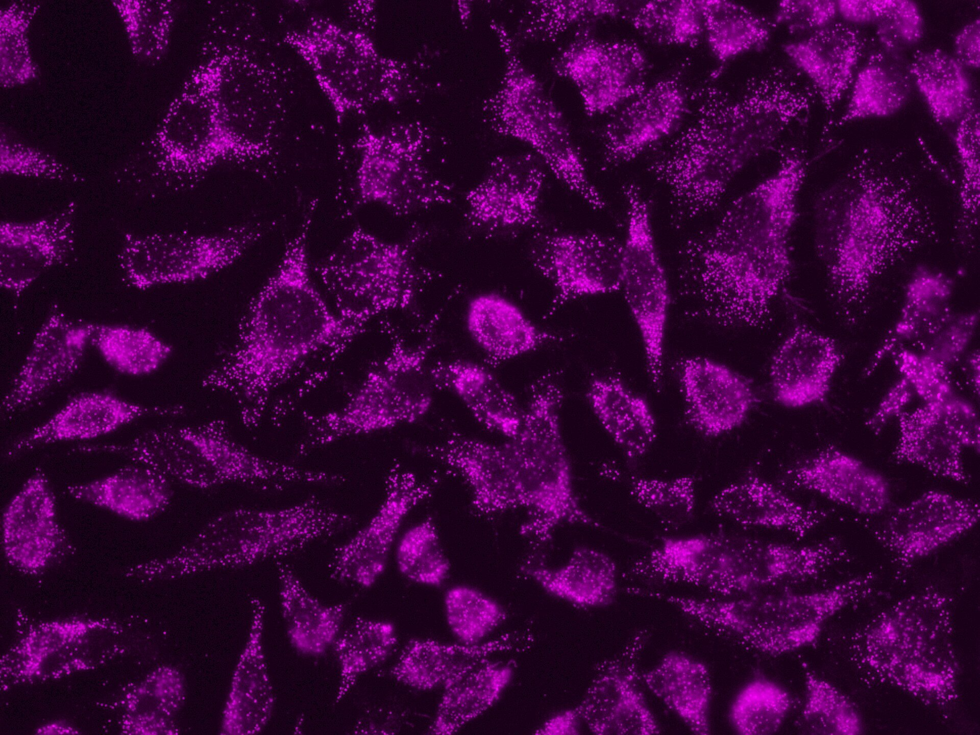 Immunofluorescent analysis of (4% PFA) fixed HeLa cells using 10594-1-AP (PEX14 antiboody) and CoraLite®647 conjugated AffiniPure F(ab')2 Fragment Goat Anti-Rabbit IgG (H+L) antibody (SA00014-9) at dilution of 1:150. 