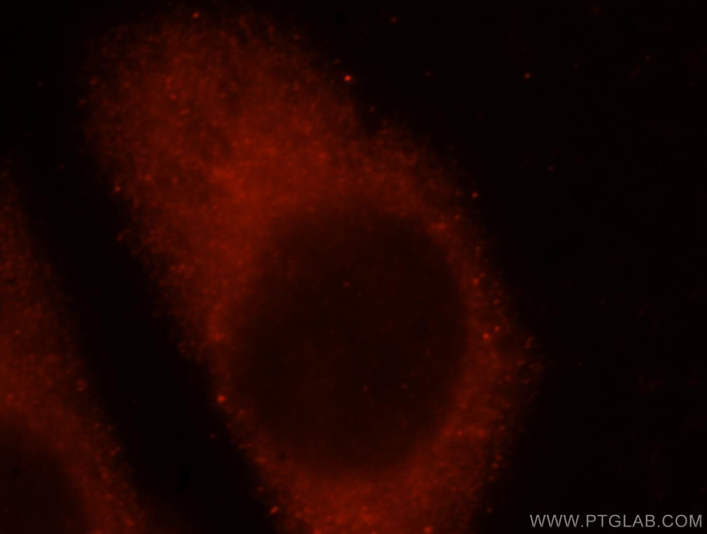 Immunofluorescence (IF) / fluorescent staining of HeLa cells using IFFO1 Polyclonal antibody (16041-1-AP)