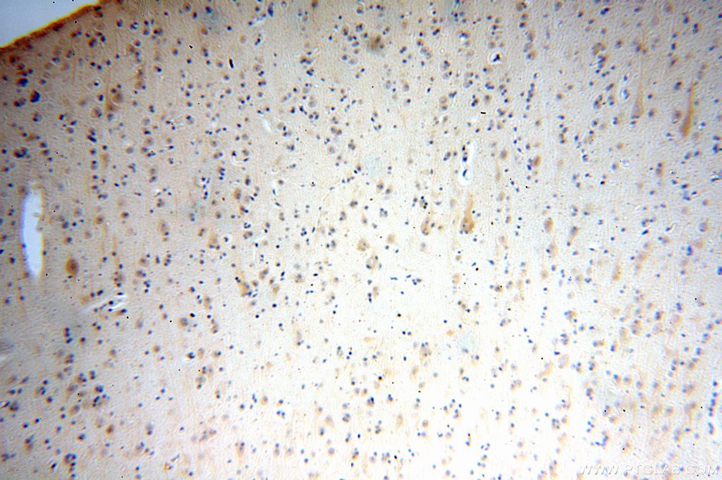 Immunohistochemistry (IHC) staining of human brain tissue using IFFO1 Polyclonal antibody (16041-1-AP)