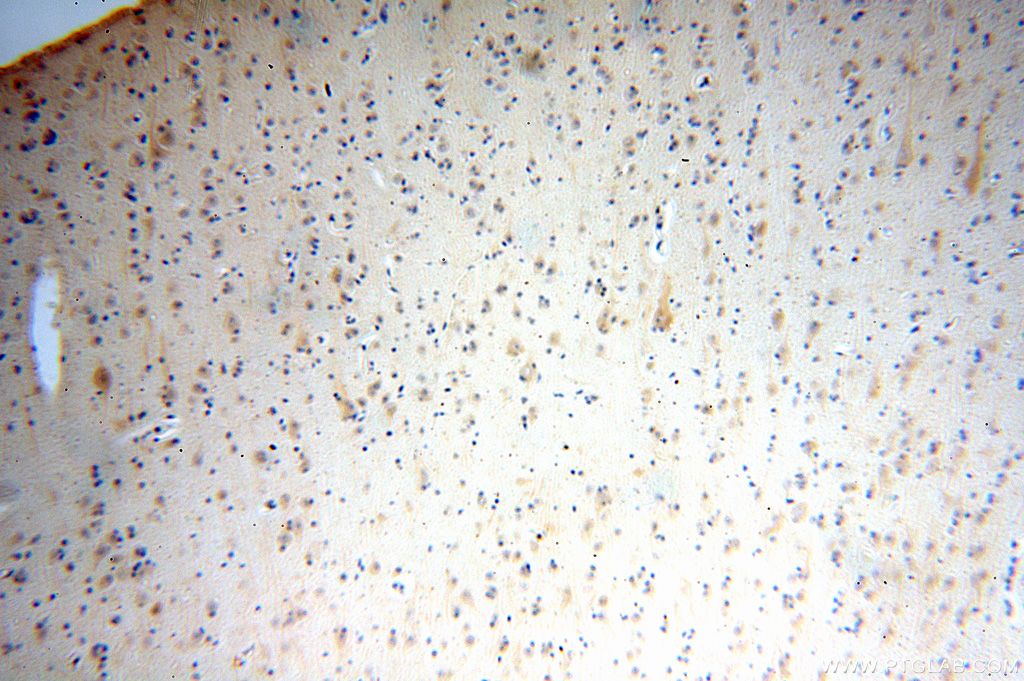 IHC staining of human brain using 16041-1-AP