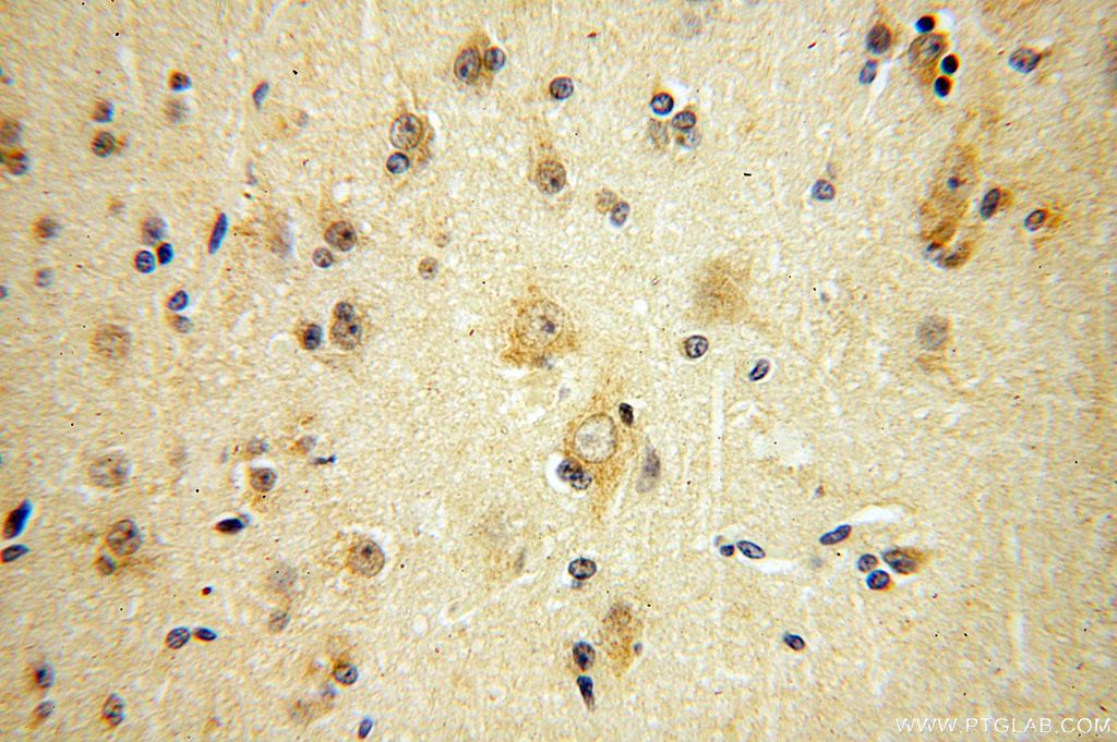 Immunohistochemistry (IHC) staining of human brain tissue using IFFO1 Polyclonal antibody (16041-1-AP)