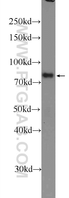 Western Blot (WB) analysis of mouse brain tissue using IFFO1 Polyclonal antibody (16041-1-AP)