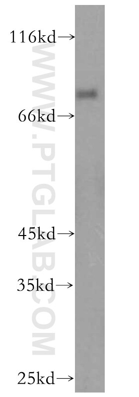 Western Blot (WB) analysis of human brain tissue using IFFO1 Polyclonal antibody (16041-1-AP)