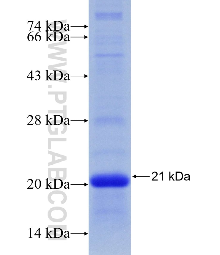 IFI16 fusion protein Ag30314 SDS-PAGE