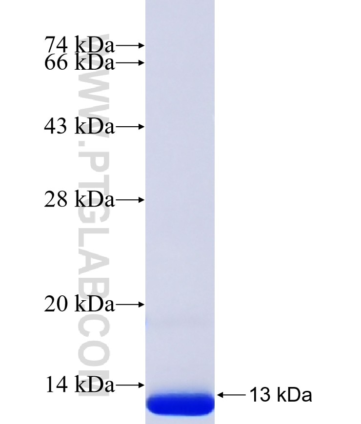 IFI27 fusion protein Ag40468 SDS-PAGE