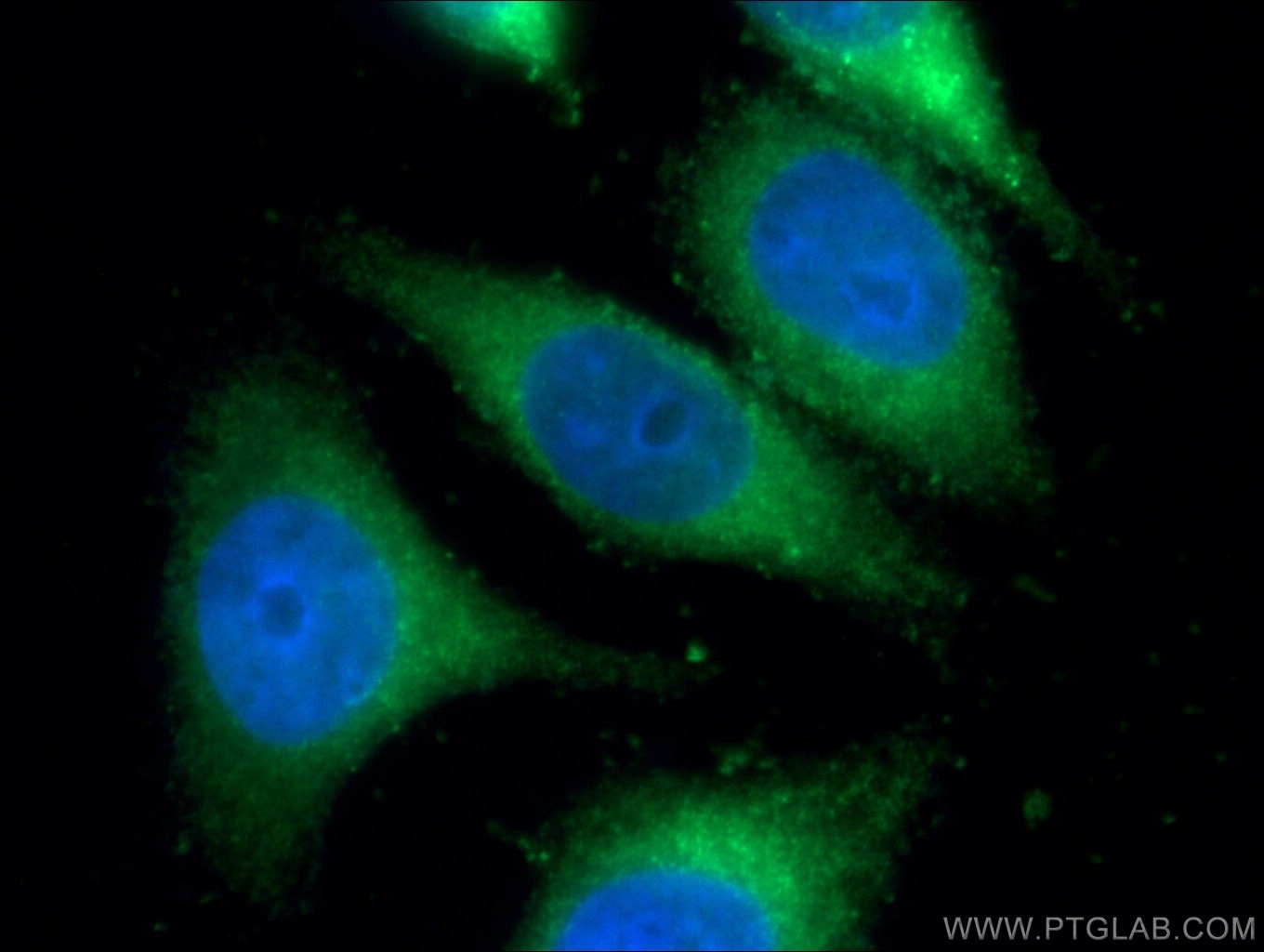 Immunofluorescence (IF) / fluorescent staining of HeLa cells using IFI30 Polyclonal antibody (11597-1-AP)