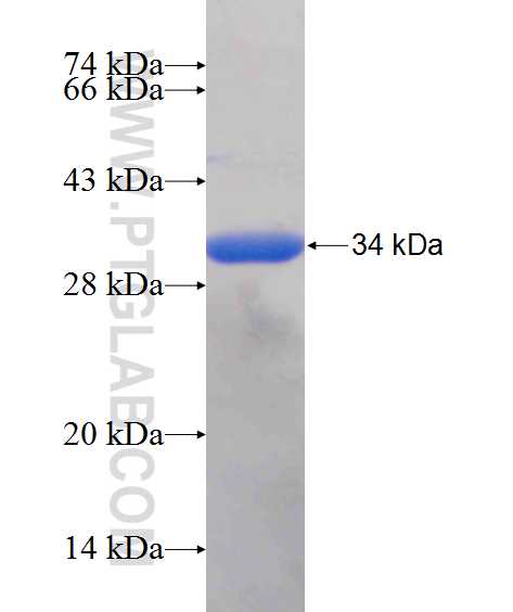 IFI30 fusion protein Ag25137 SDS-PAGE