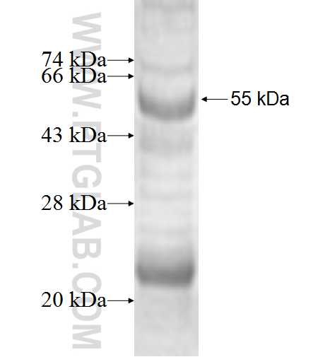IFI30 fusion protein Ag2178 SDS-PAGE