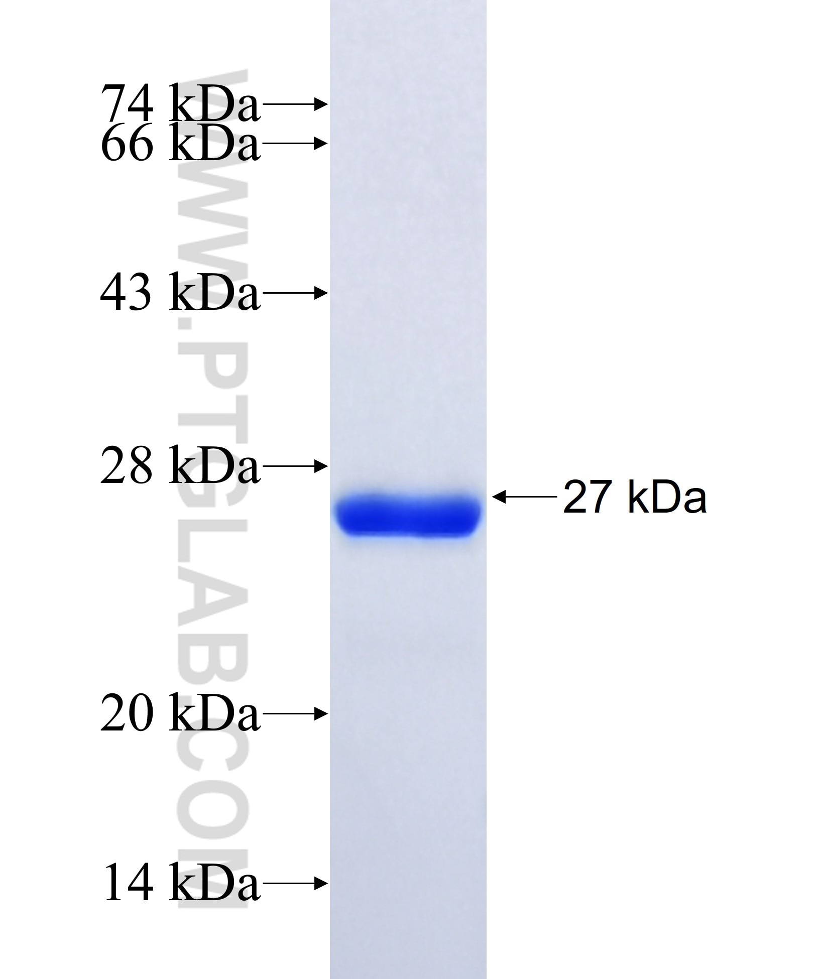 IFI35 fusion protein Ag34694 SDS-PAGE IFI35 fusion protein Ag34694 SDS-PAGE