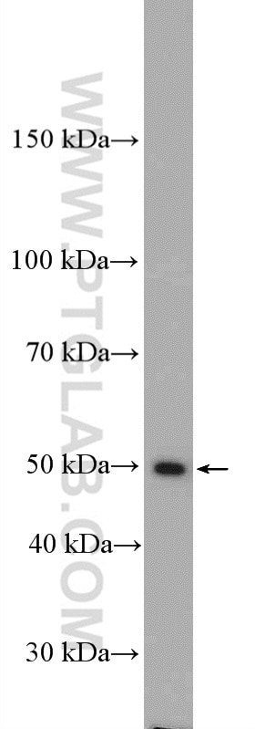Western Blot (WB) analysis of mouse kidney tissue using IFI44 Polyclonal antibody (27233-1-AP)