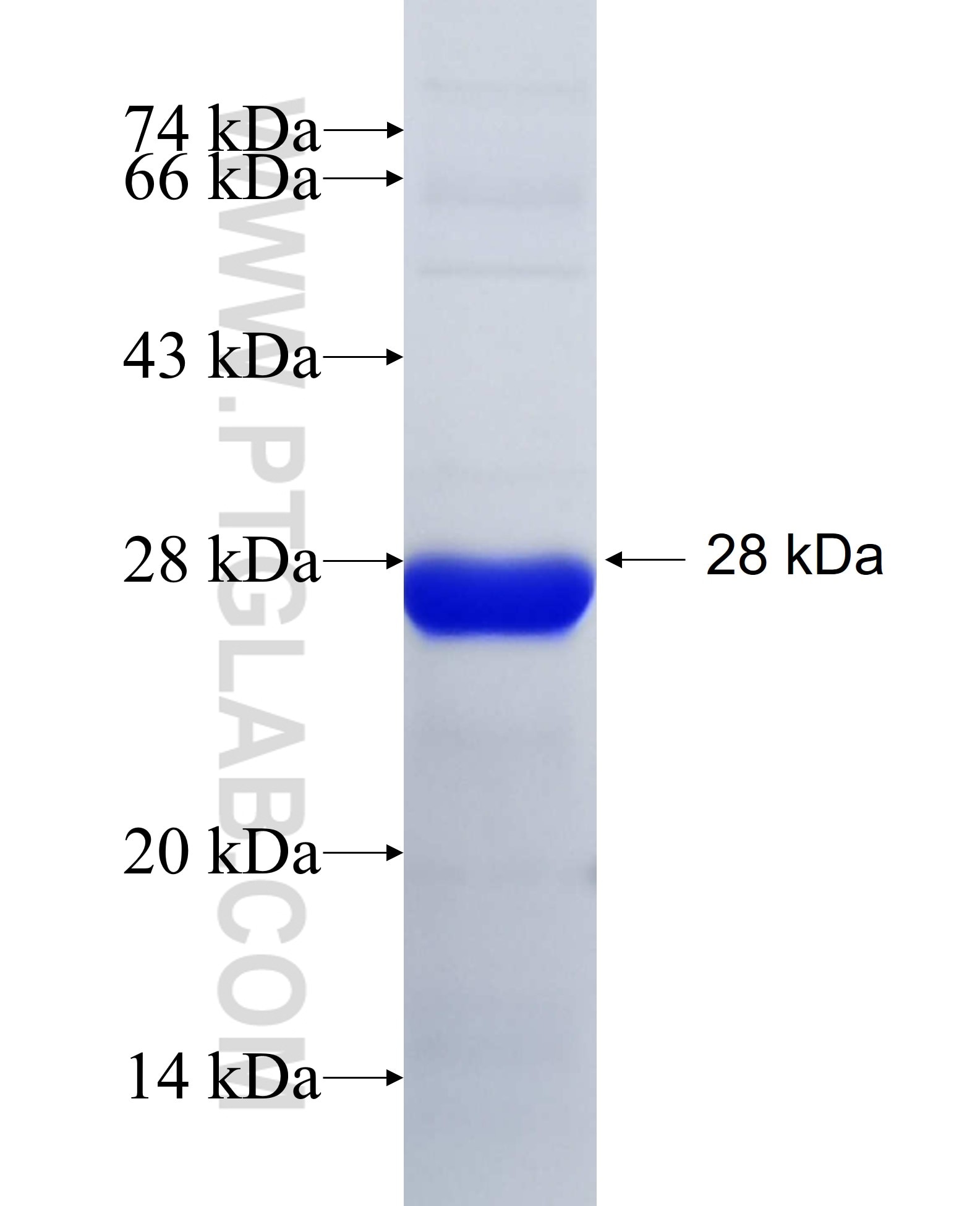IFI44 fusion protein Ag25974 SDS-PAGE