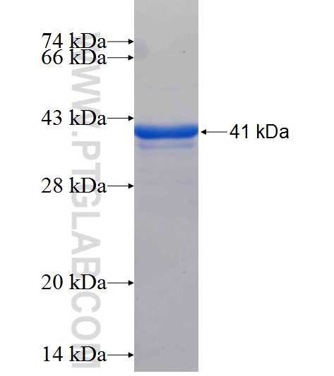 IFI44 fusion protein Ag26121 SDS-PAGE