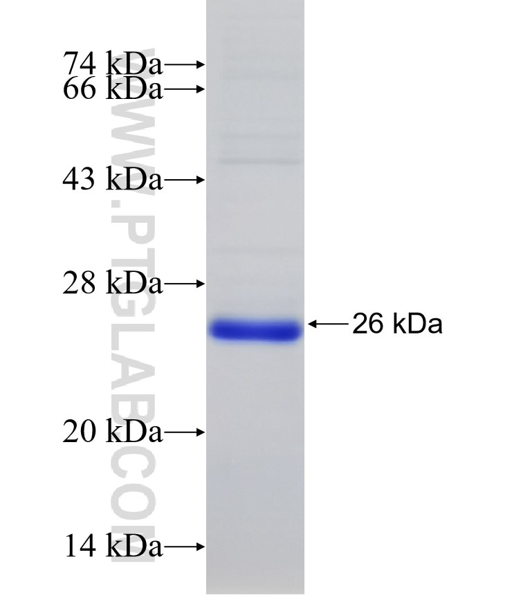 IFI44 fusion protein Ag33799 SDS-PAGE
