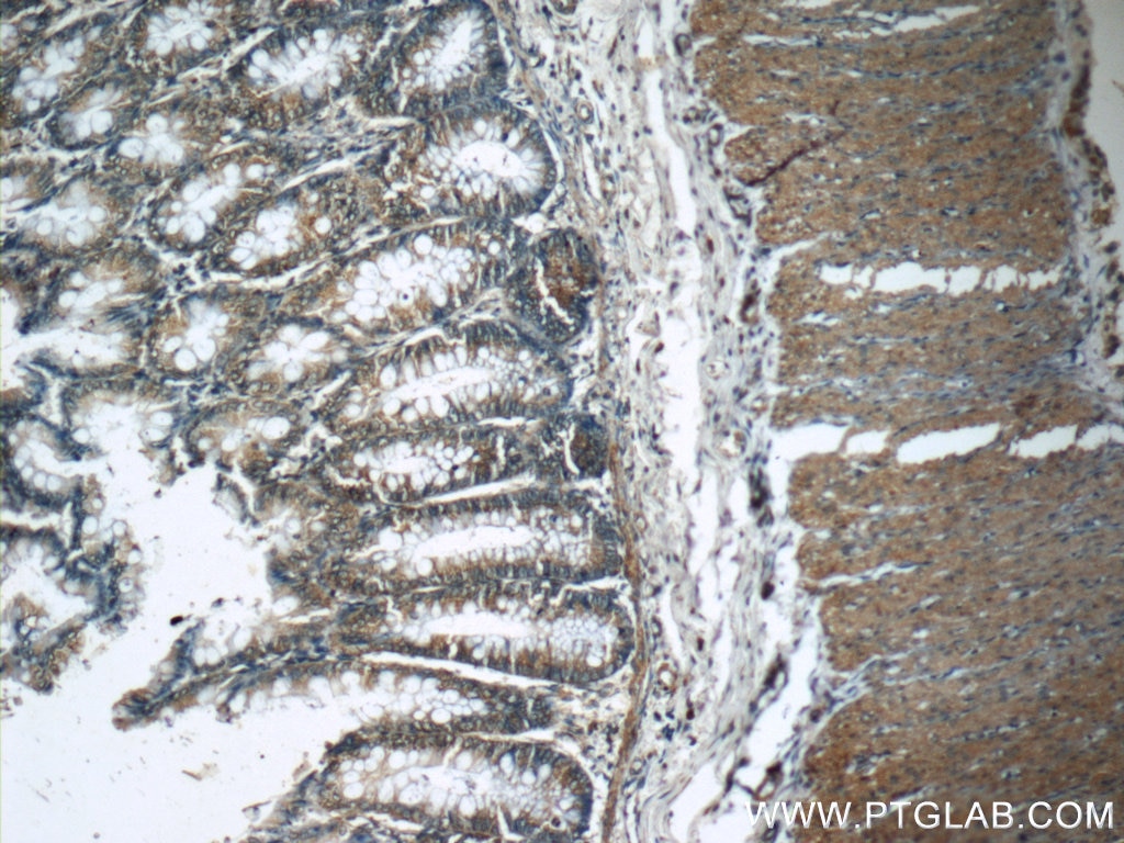 IHC staining of human colon using 11246-1-AP