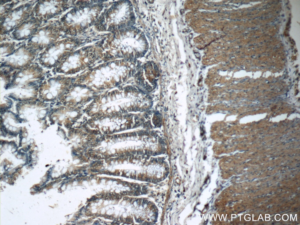 Immunohistochemistry (IHC) staining of human colon tissue using G1P3 Polyclonal antibody (11246-1-AP)