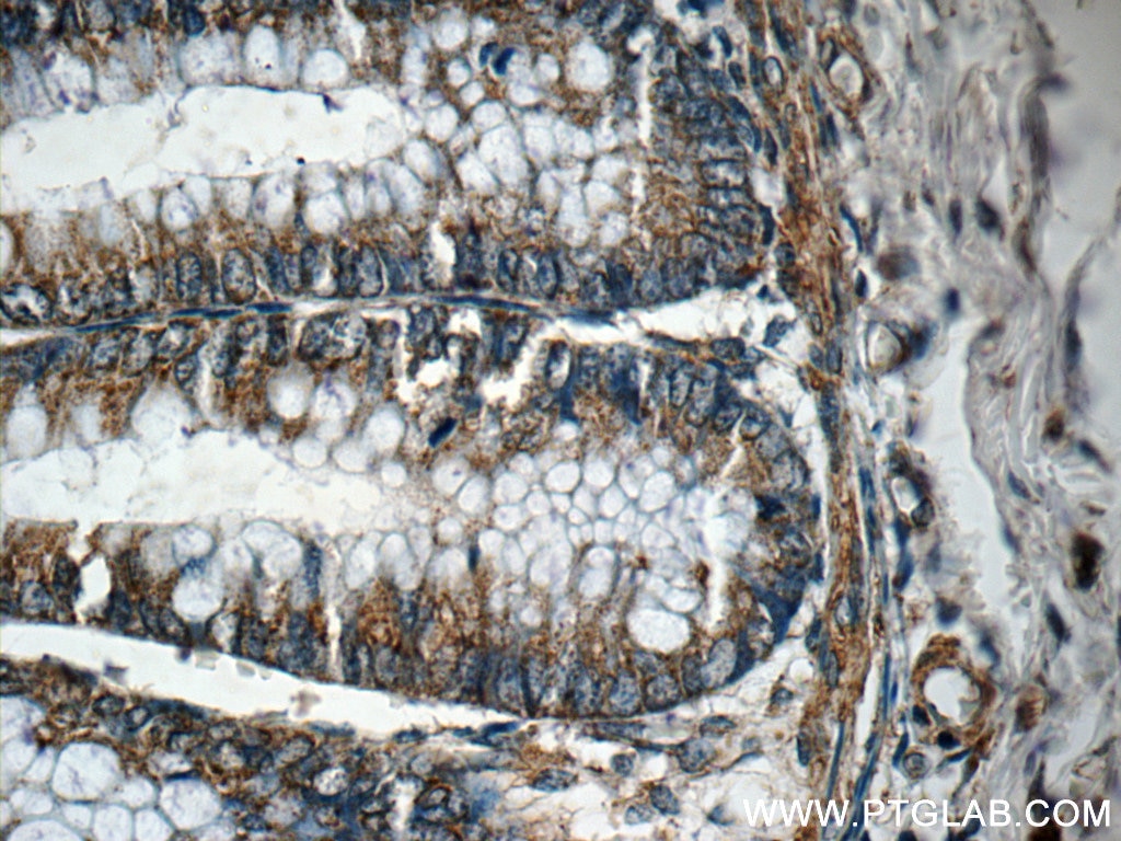 Immunohistochemistry (IHC) staining of human colon tissue using G1P3 Polyclonal antibody (11246-1-AP)