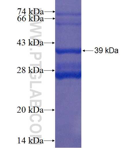 G1P3 fusion protein Ag1765 SDS-PAGE
