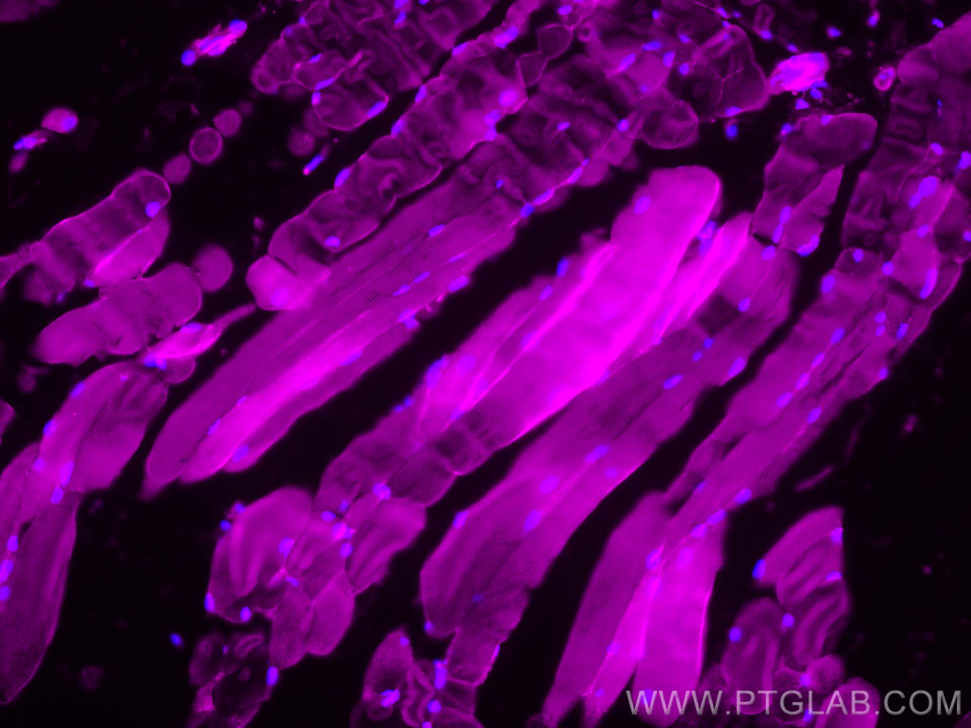 Immunofluorescence (IF) / fluorescent staining of mouse skeletal muscle tissue using IFIH1/MDA5 Polyclonal antibody (21775-1-AP)