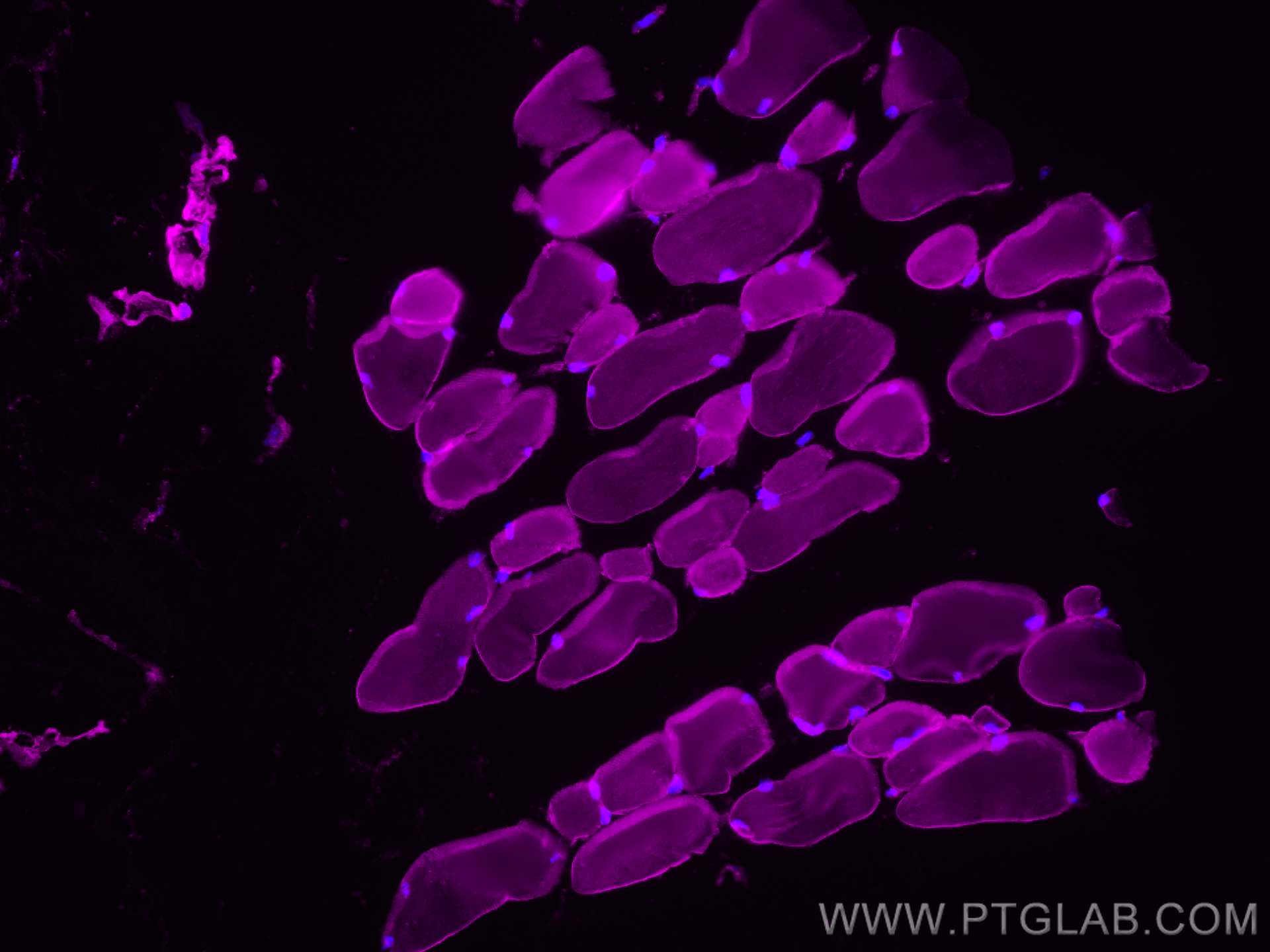 Immunofluorescence (IF) / fluorescent staining of mouse skeletal muscle tissue using IFIH1/MDA5 Polyclonal antibody (21775-1-AP)
