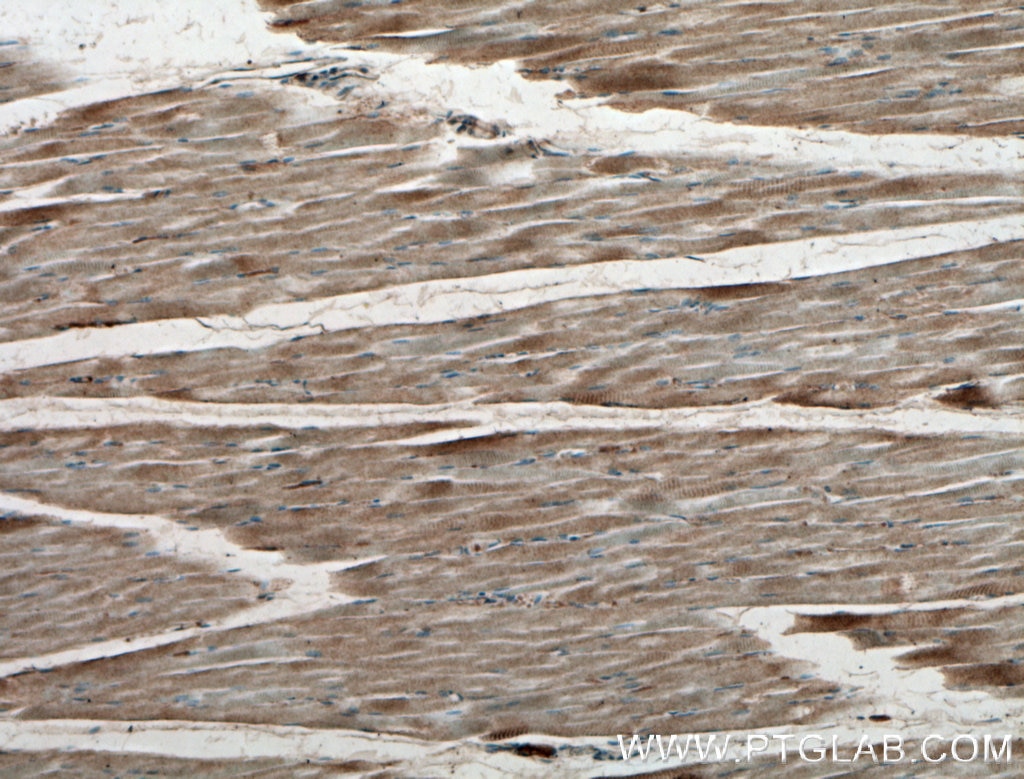 Immunohistochemistry (IHC) staining of human skeletal muscle tissue using IFIH1/MDA5 Polyclonal antibody (21775-1-AP)