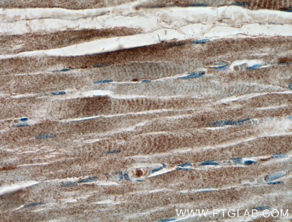 Immunohistochemistry (IHC) staining of human skeletal muscle tissue using IFIH1/MDA5 Polyclonal antibody (21775-1-AP)