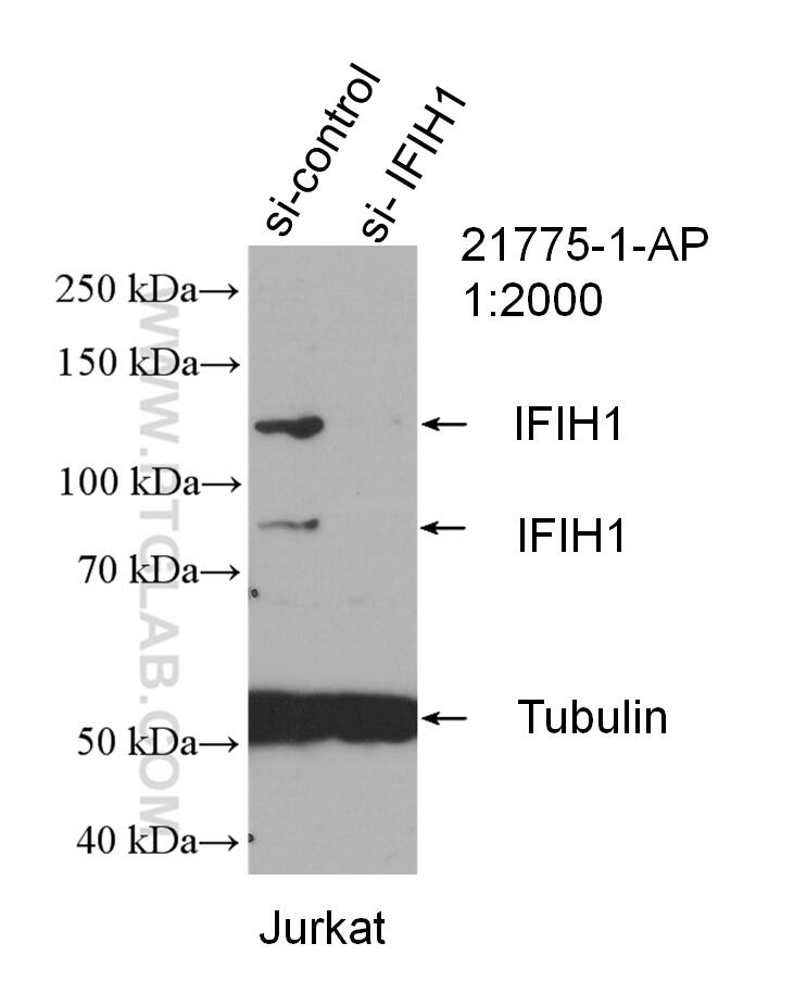 Western Blot (WB) analysis of Jurkat cells using IFIH1/MDA5 Polyclonal antibody (21775-1-AP)