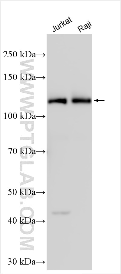 Western Blot (WB) analysis of various lysates using IFIH1/MDA5 Polyclonal antibody (21775-1-AP)