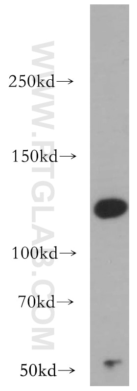 Western Blot (WB) analysis of Jurkat cells using IFIH1/MDA5 Polyclonal antibody (21775-1-AP)