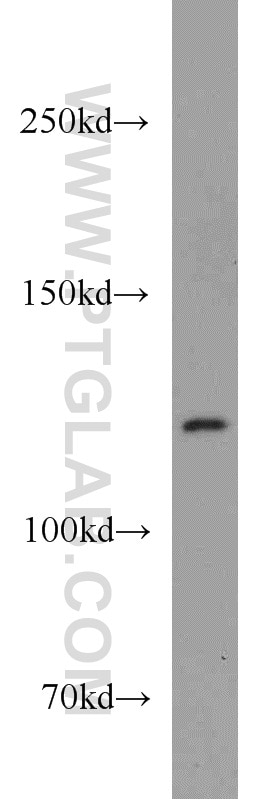 Western Blot (WB) analysis of Jurkat cells using IFIH1/MDA5 Polyclonal antibody (21775-1-AP)
