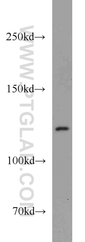 WB analysis of Jurkat using 21775-1-AP