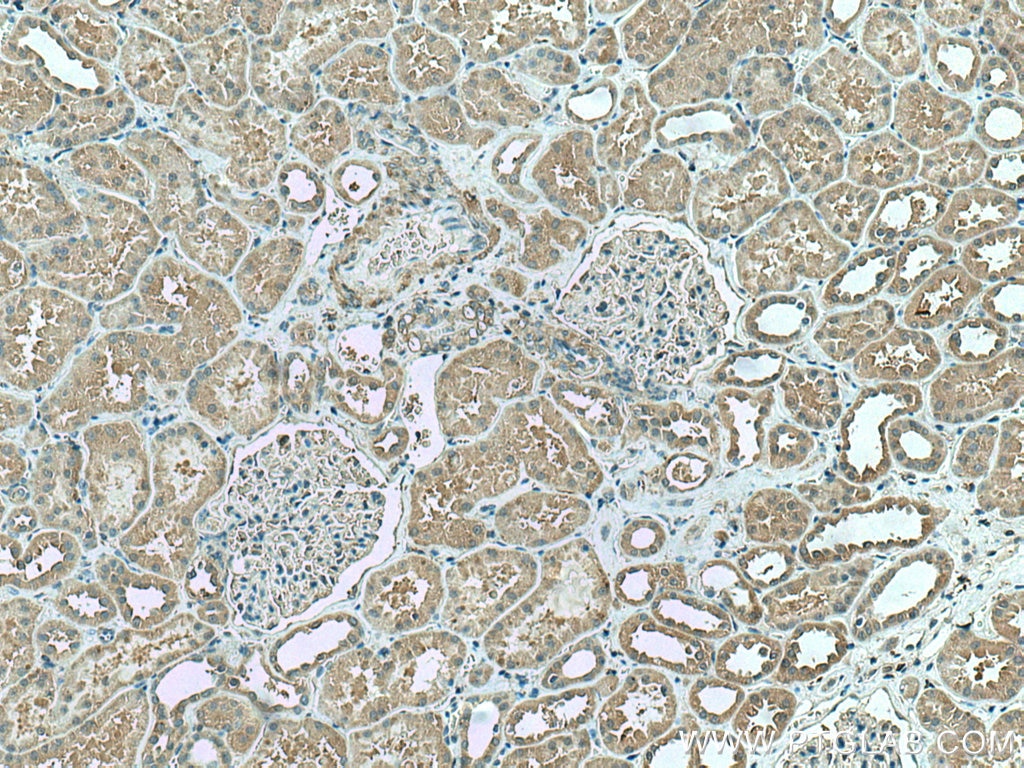 Immunohistochemistry (IHC) staining of human kidney tissue using IFIH1/MDA5 Monoclonal antibody (66770-1-Ig)