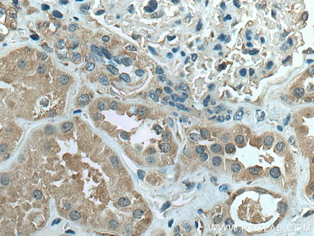 Immunohistochemistry (IHC) staining of human kidney tissue using IFIH1/MDA5 Monoclonal antibody (66770-1-Ig)