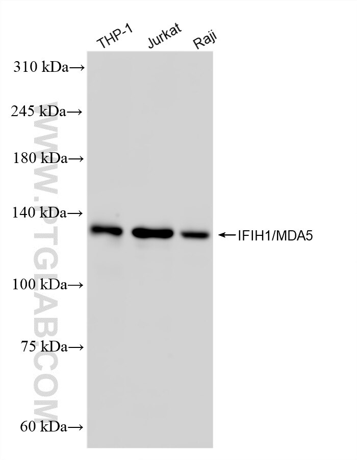 Western Blot (WB) analysis of various lysates using IFIH1/MDA5 Recombinant monoclonal antibody (87135-1-RR)