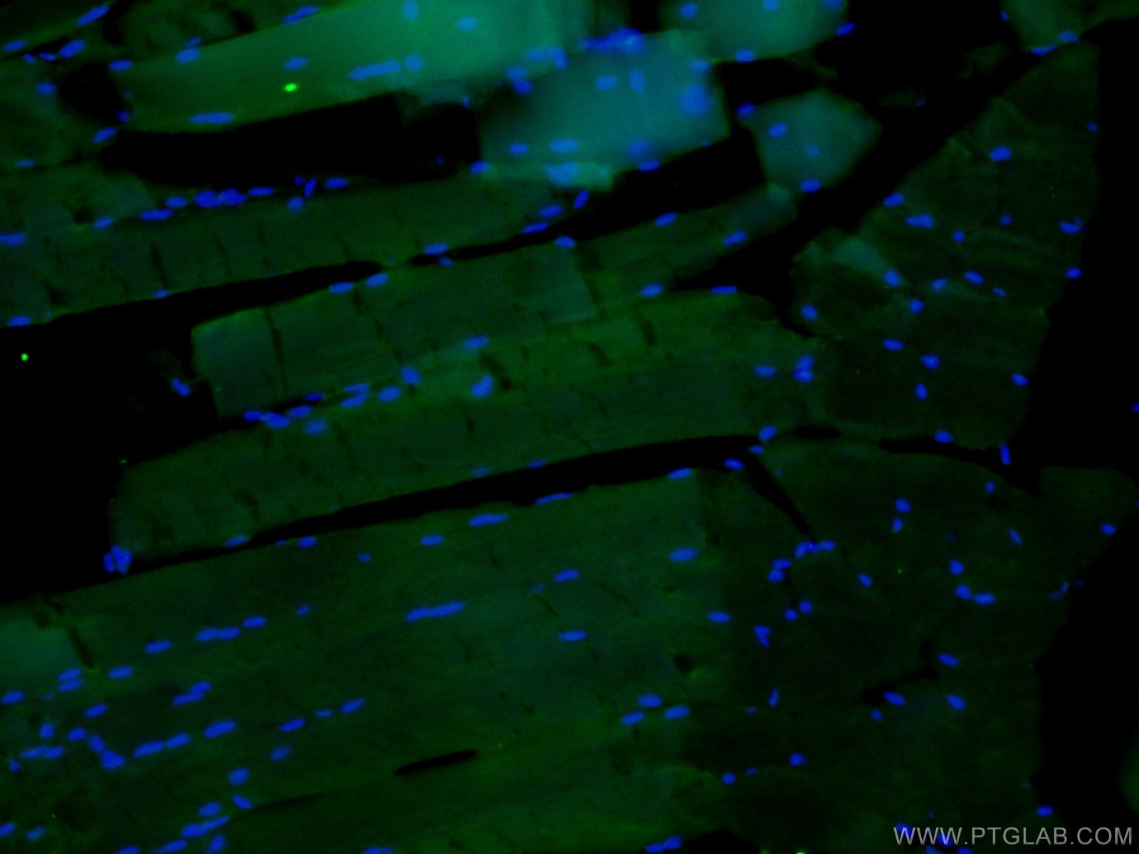 Immunofluorescence (IF) / fluorescent staining of mouse skeletal muscle tissue using CoraLite®488-conjugated IFIH1 Polyclonal antibody (CL488-21775)
