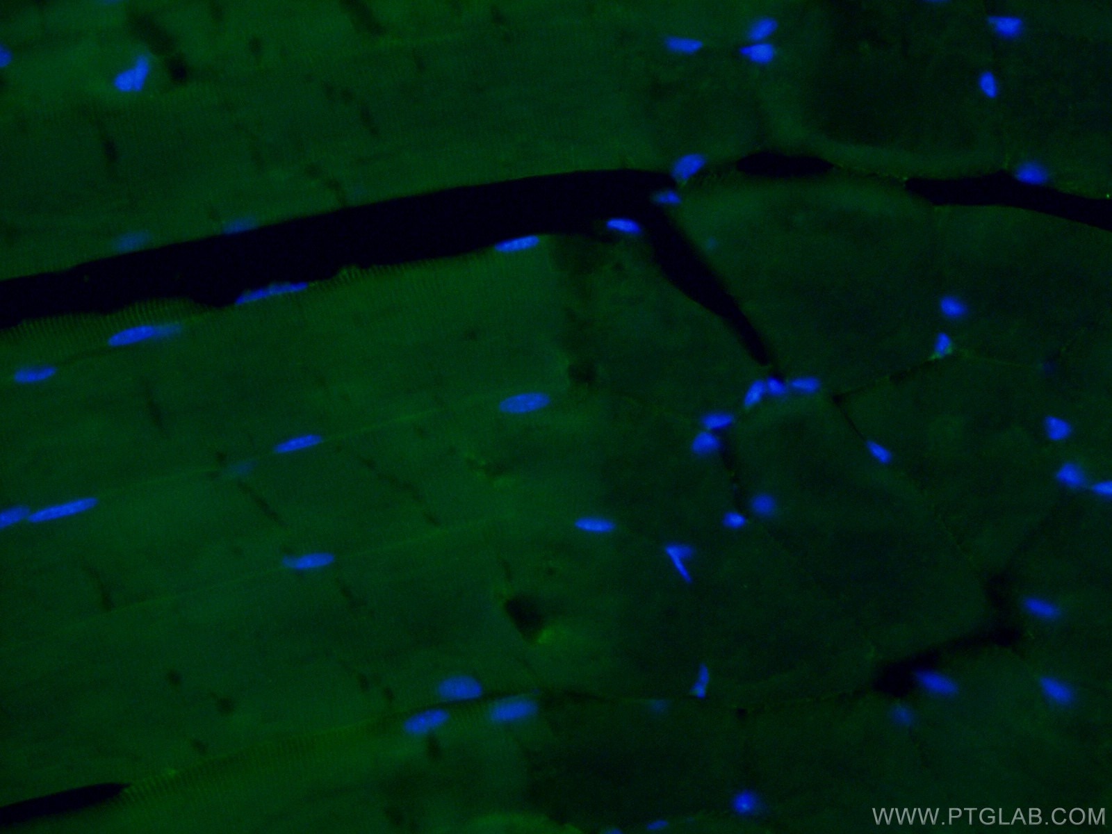 Immunofluorescence (IF) / fluorescent staining of mouse skeletal muscle tissue using CoraLite®488-conjugated IFIH1 Polyclonal antibody (CL488-21775)