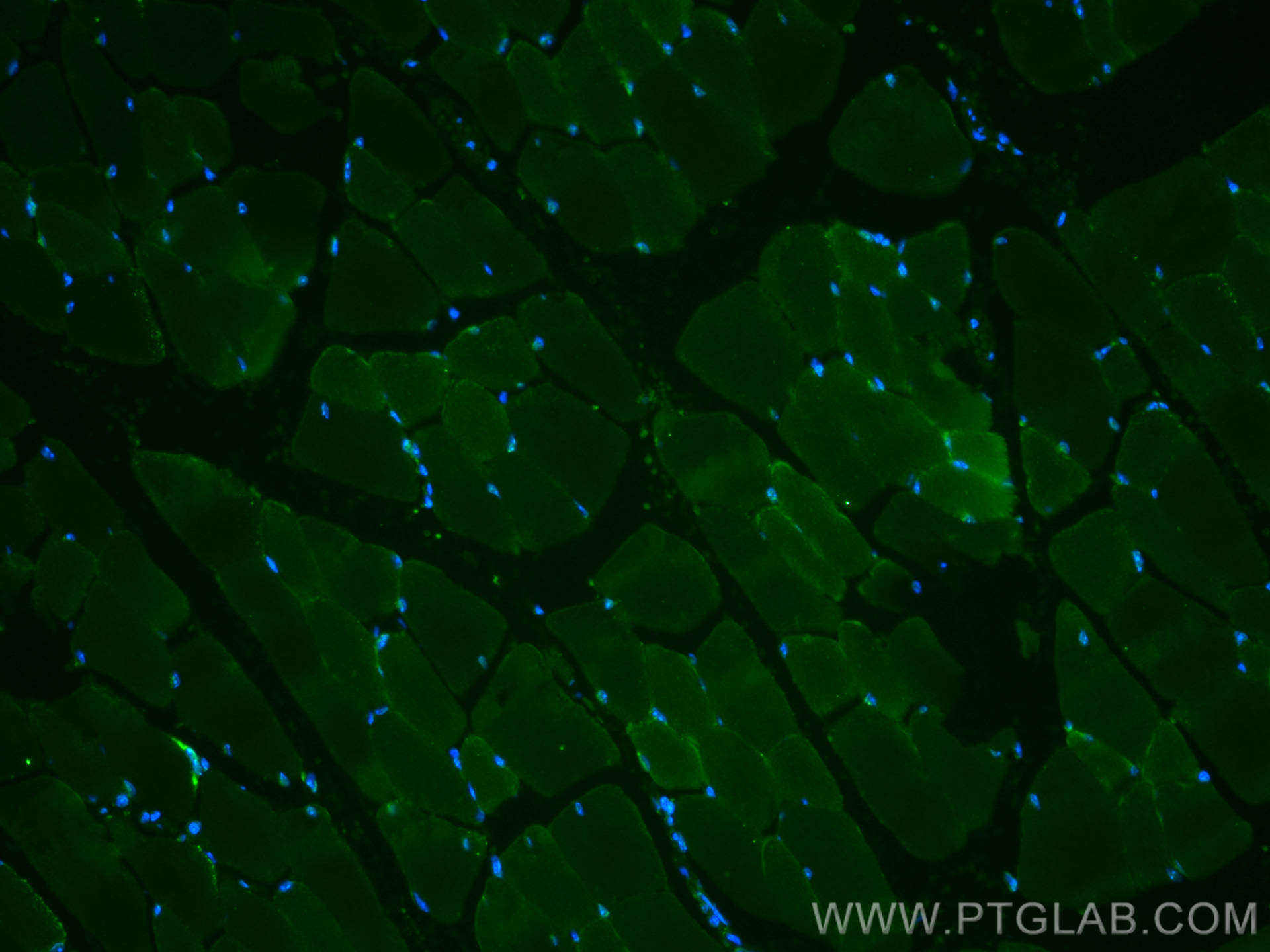 Immunofluorescence (IF) / fluorescent staining of mouse skeletal muscle tissue using CoraLite®488-conjugated IFIH1 Polyclonal antibody (CL488-21775)