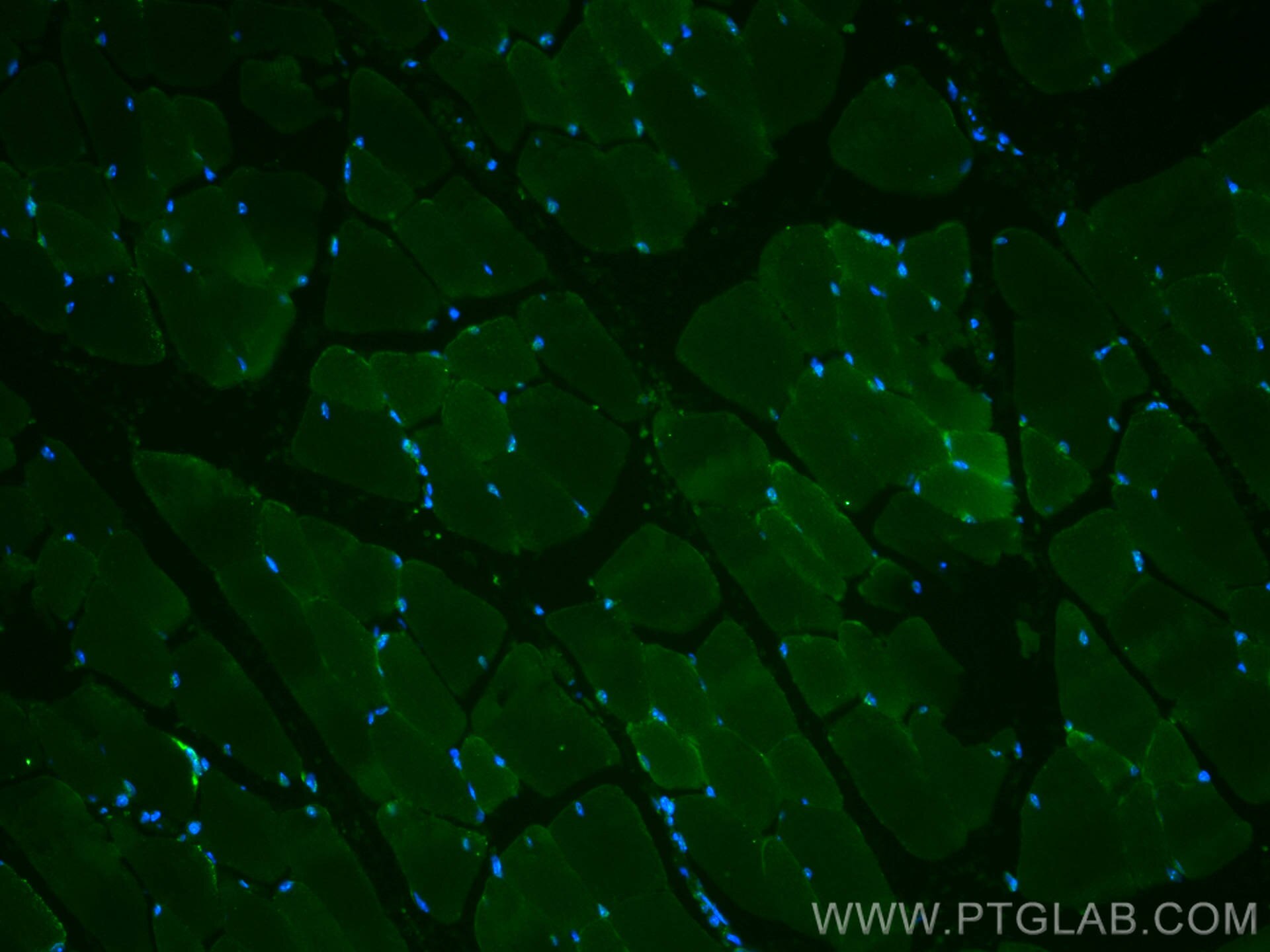 Immunofluorescence (IF) / fluorescent staining of mouse skeletal muscle tissue using CoraLite®488-conjugated IFIH1 Polyclonal antibody (CL488-21775)