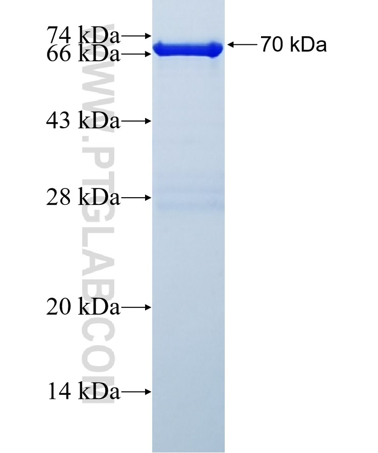 IFIH1 fusion protein Ag16467 SDS-PAGE