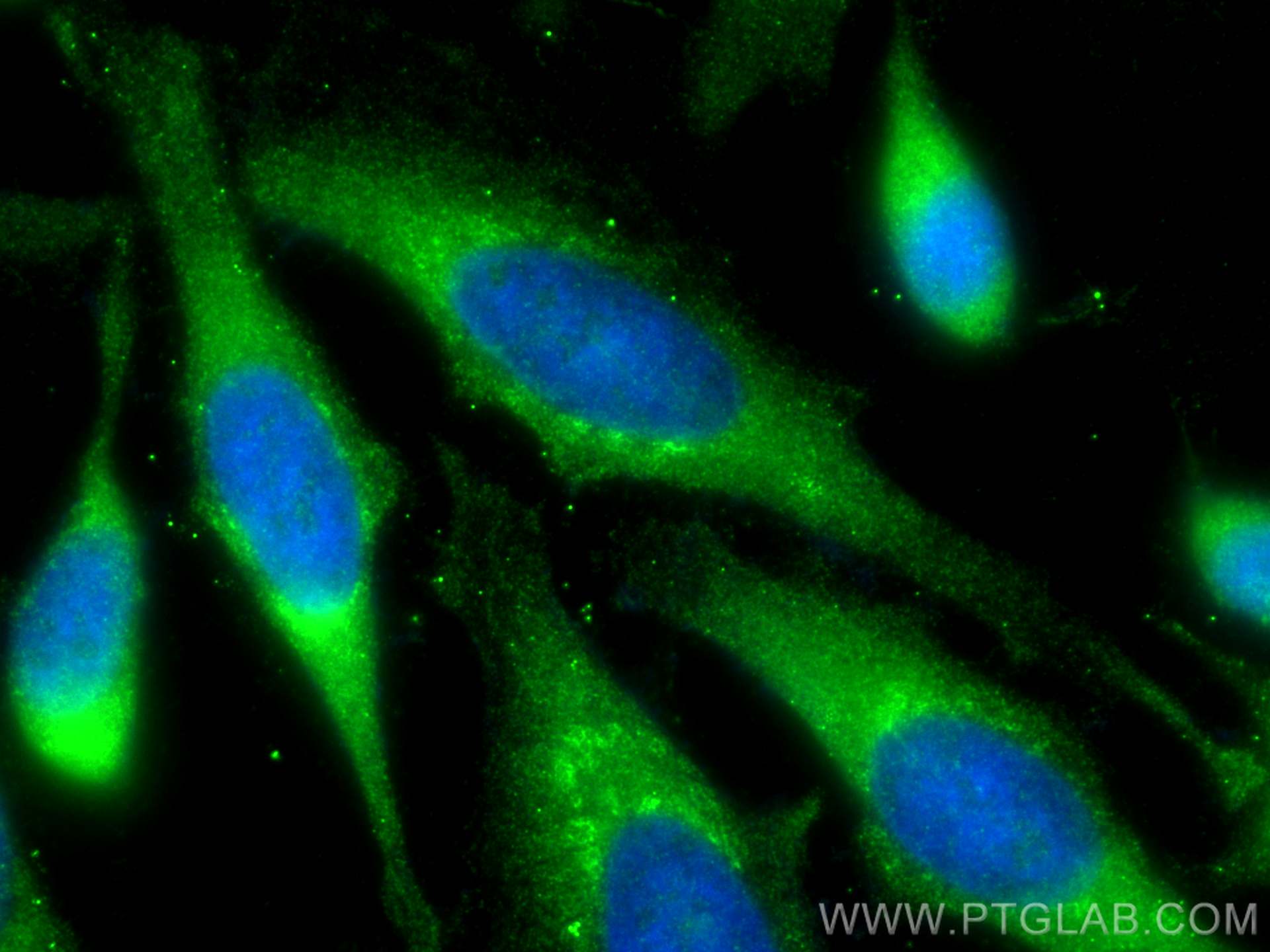 Immunofluorescence (IF) / fluorescent staining of HeLa cells using IFIT1 Polyclonal antibody (23247-1-AP)