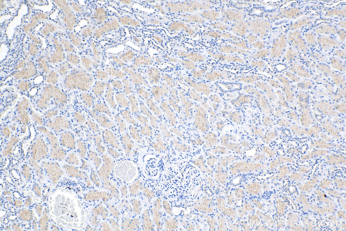Immunohistochemistry (IHC) staining of human kidney tissue using IFIT1 Polyclonal antibody (23247-1-AP)